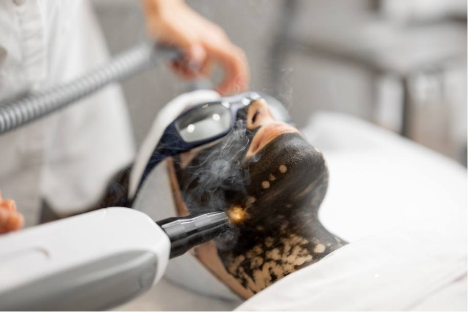 Laser Skin Treatment in pune 2