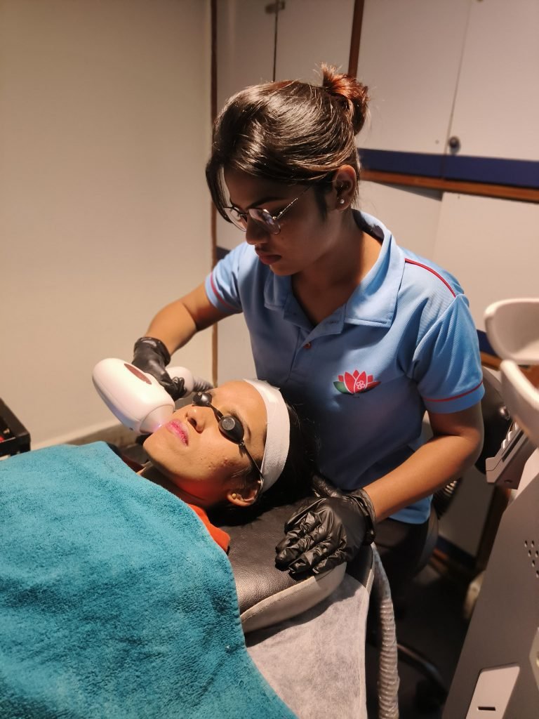 laser hair reduction